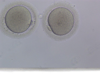 Oocyte Cryopreservation / Egg freezing