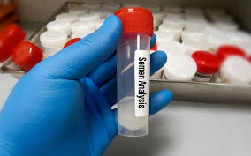 Semen Analysis test